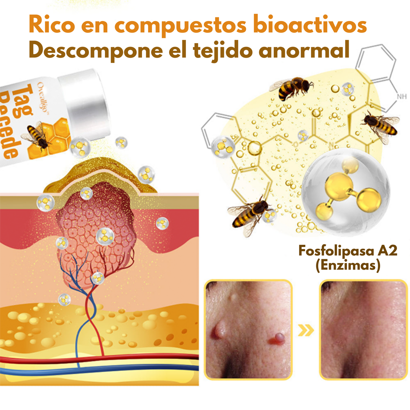 TIWORLD™TAG RECEDE - TRATAMIENDO PARA VERRUGA Y LUNARES