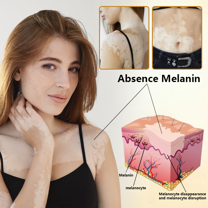 Ceoerty™ - Crema revitalizante con veneno de abeja