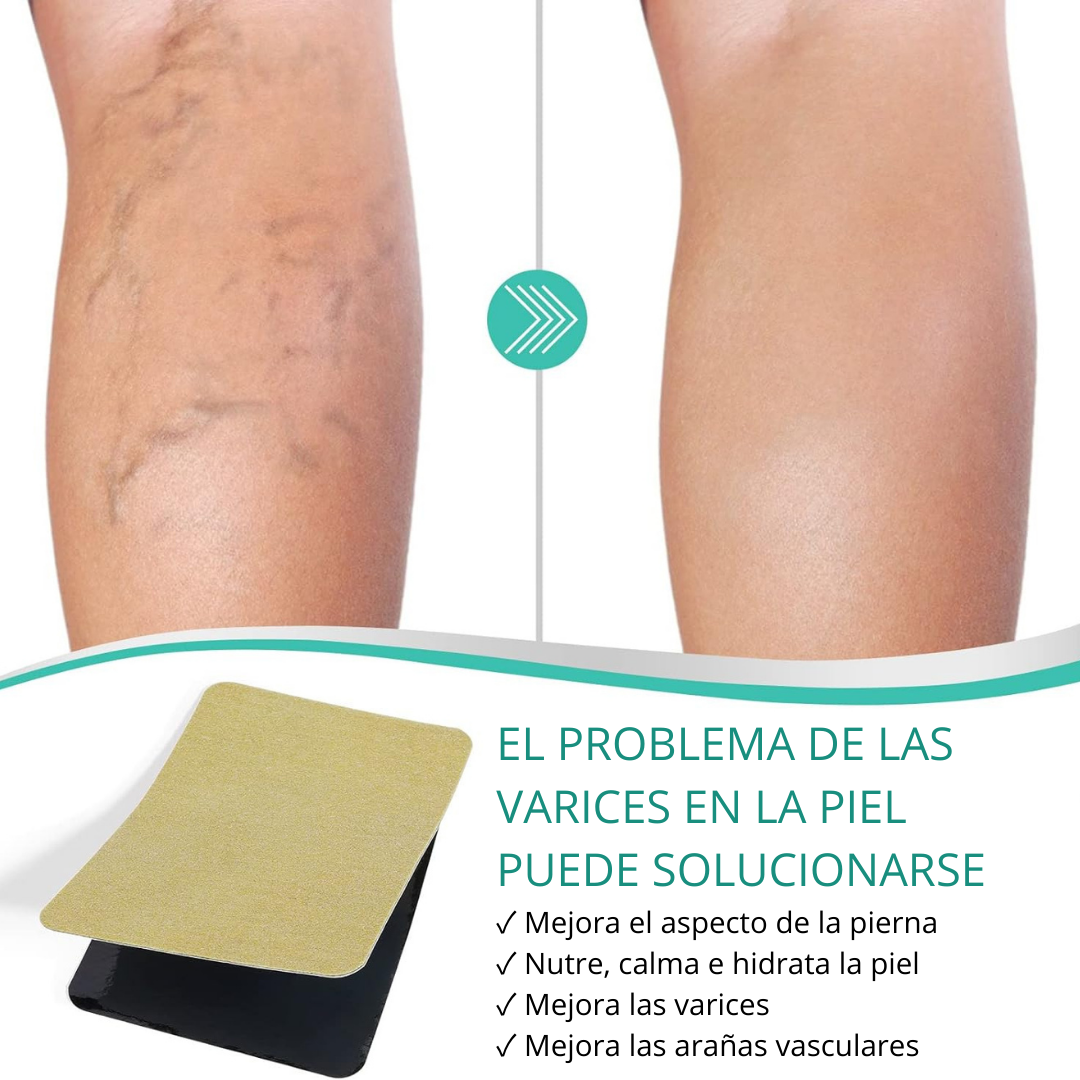VEINS PARCH ™: ELIMINA VARICES CON FÓRMULA NATURAL🌿 RESULTADOS EN 10 DÍAS👨‍⚕️  OFERTA ESPECIAL 2X1🎁😵