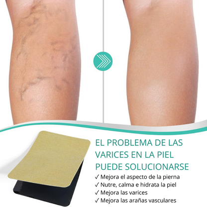 VEINS PARCH ™: ELIMINA VARICES CON FÓRMULA NATURAL🌿 RESULTADOS EN 10 DÍAS👨‍⚕️  OFERTA ESPECIAL 2X1🎁😵