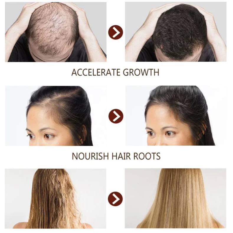 Aceite de Cabello Disaar Hair Care - Tratamiento anti caída y crecimiento capilar