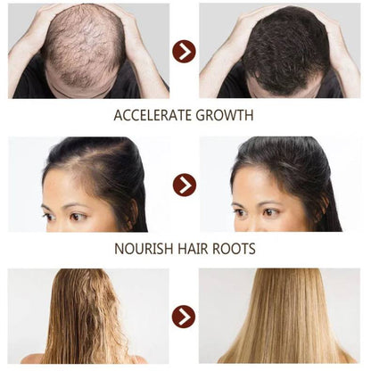 Aceite de Cabello Disaar Hair Care - Tratamiento anti caída y crecimiento capilar