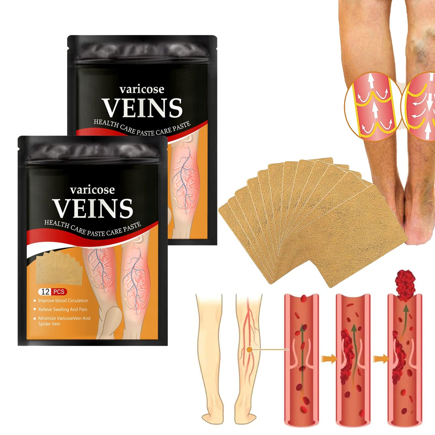 VEINS PARCH ™: ELIMINA VARICES CON FÓRMULA NATURAL🌿 RESULTADOS EN 10 DÍAS👨‍⚕️  OFERTA ESPECIAL 2X1🎁😵