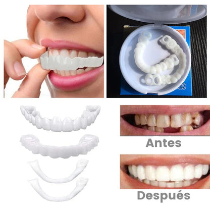 ¡OFERTA ESPECIAL 3X1 🤯SOLO POR ESTA SEMANA!🎁Carillas Dentales SnapOnSmile®- ORIGINAL